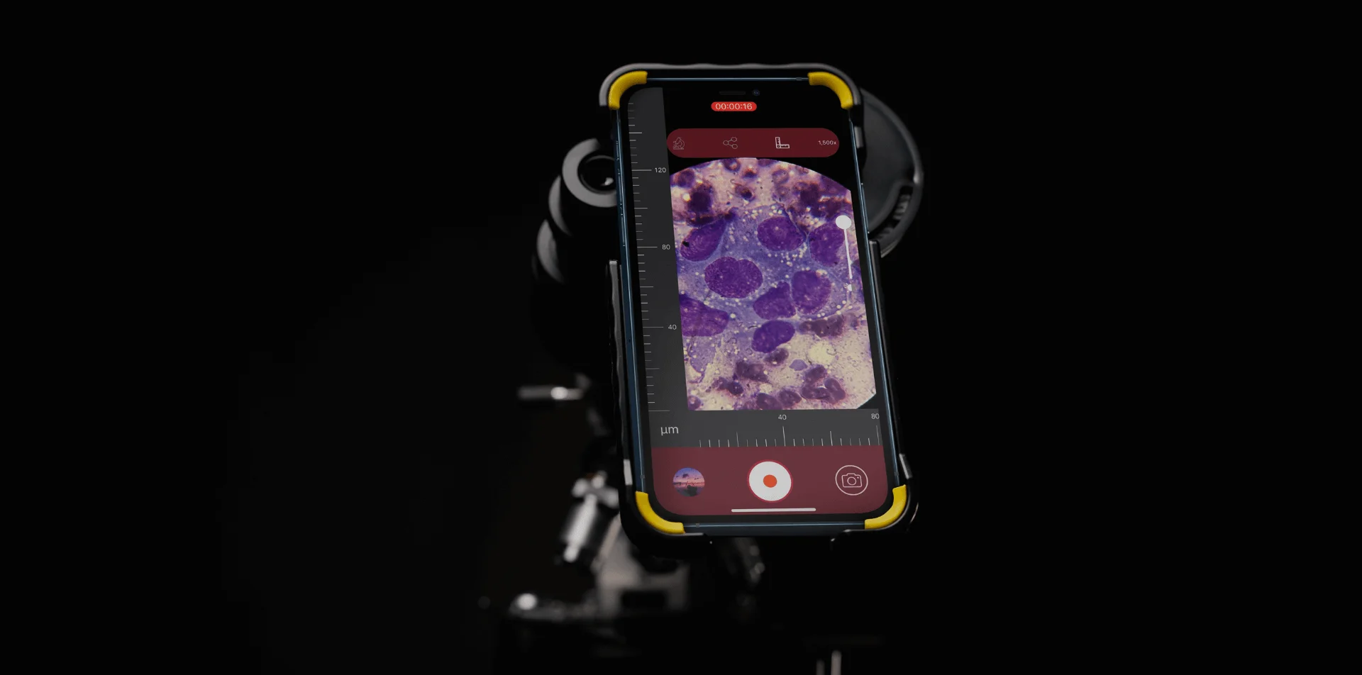 Phoneskope adapter with Microscope and Phone